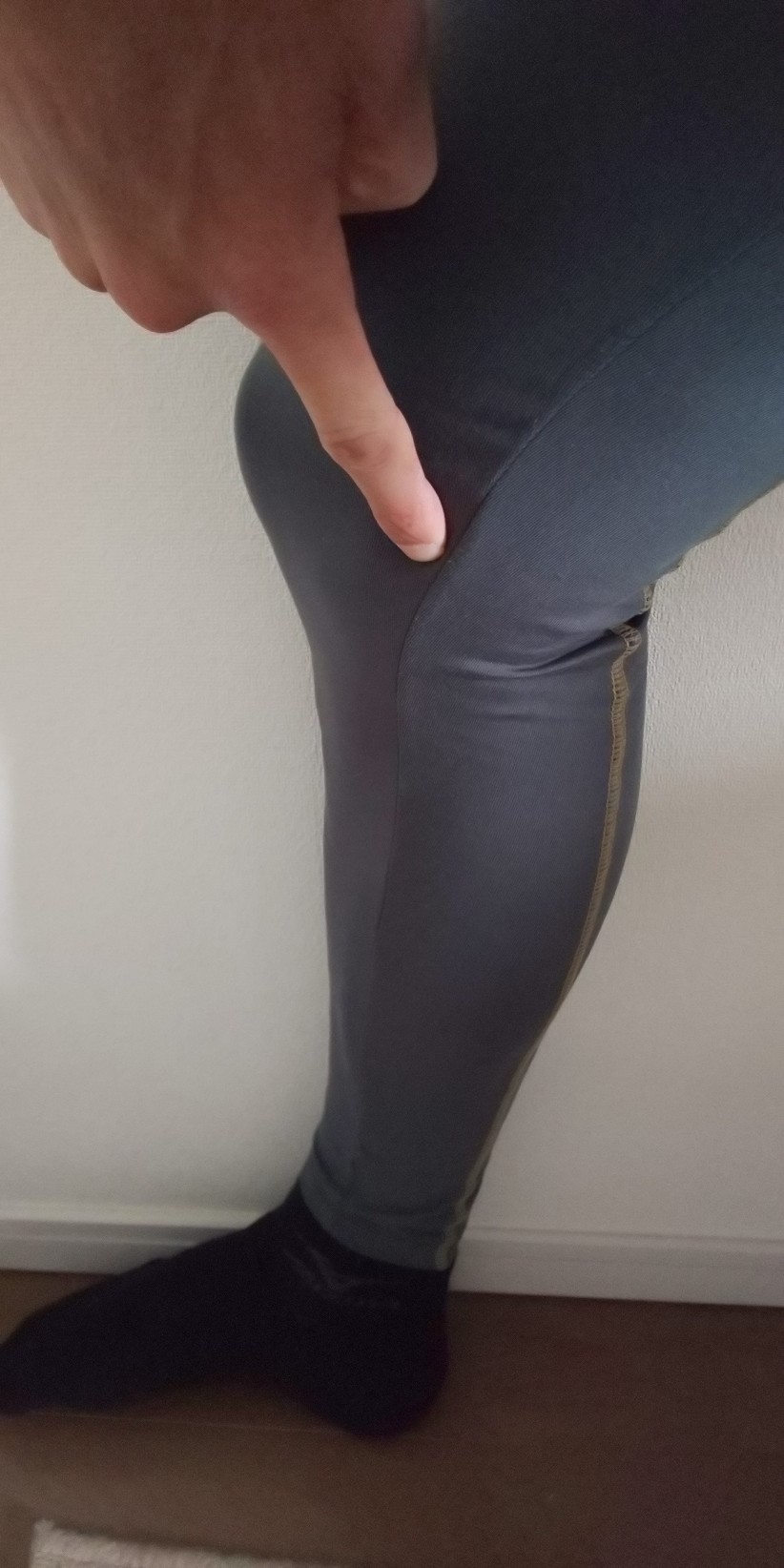 #82 膝の内側の痛み